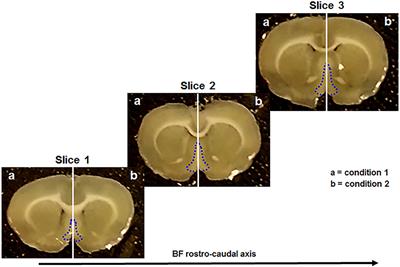 Modulatory Effects of a Novel Cyclized Peptide in Reducing the Expression of Markers Linked to Alzheimer's Disease